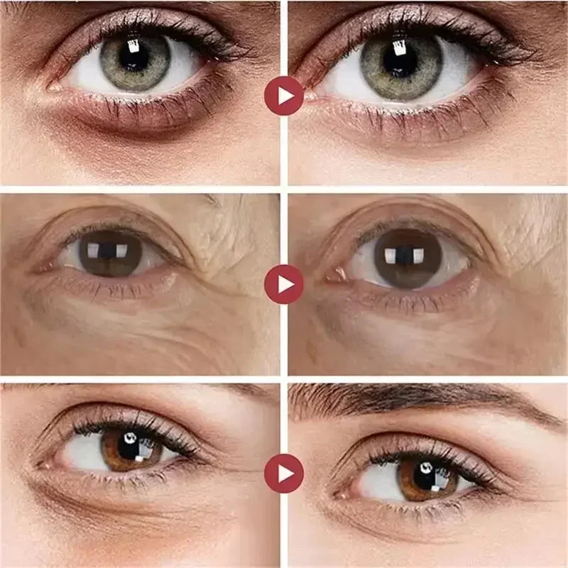 Safora™ Gezichtsstrakker Crème